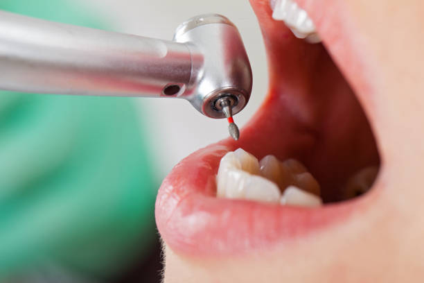 Best Teeth Whitening  in Reading, MI
